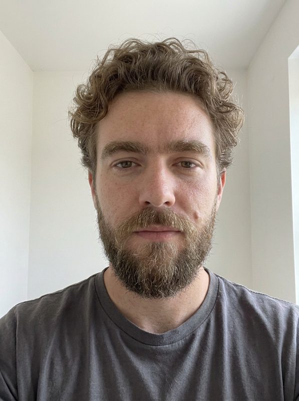 AFTER: AI-generated example. Not a real person.