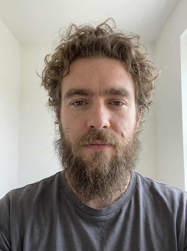 BEFORE: AI-generated example. Not a real person.